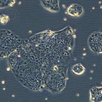 浙江(杭州)美森 人胰腺癌细胞 Capan-2