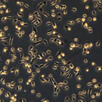 浙江（杭州）美森 肝癌细胞 SNU449