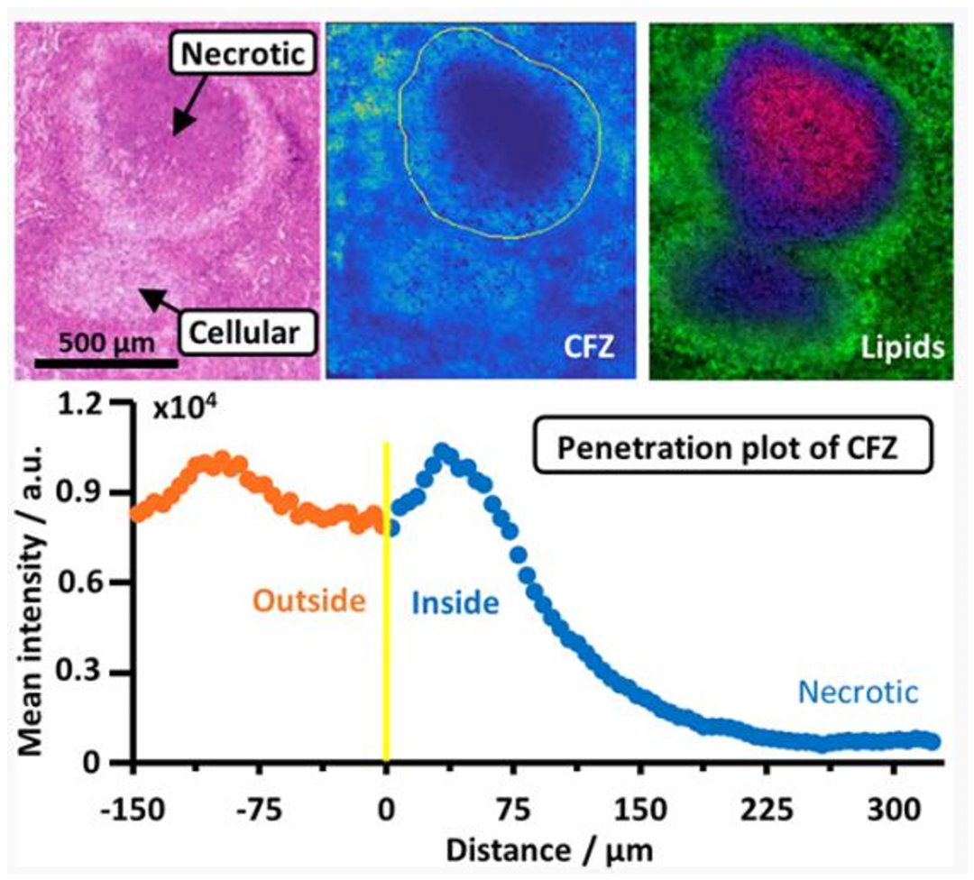 与典同行|质谱成像助力药物研究进入“空间组学”时代