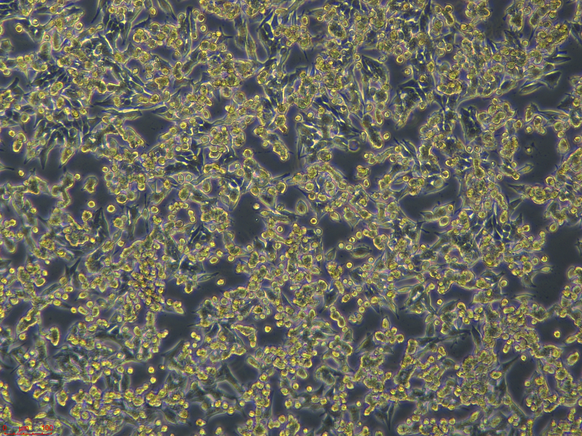 Project1_A-375    10X_ch00.jpg