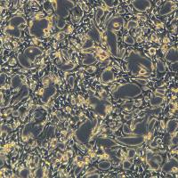 浙江（杭州）美森 小鼠恶性乳腺癌细胞 PY8119