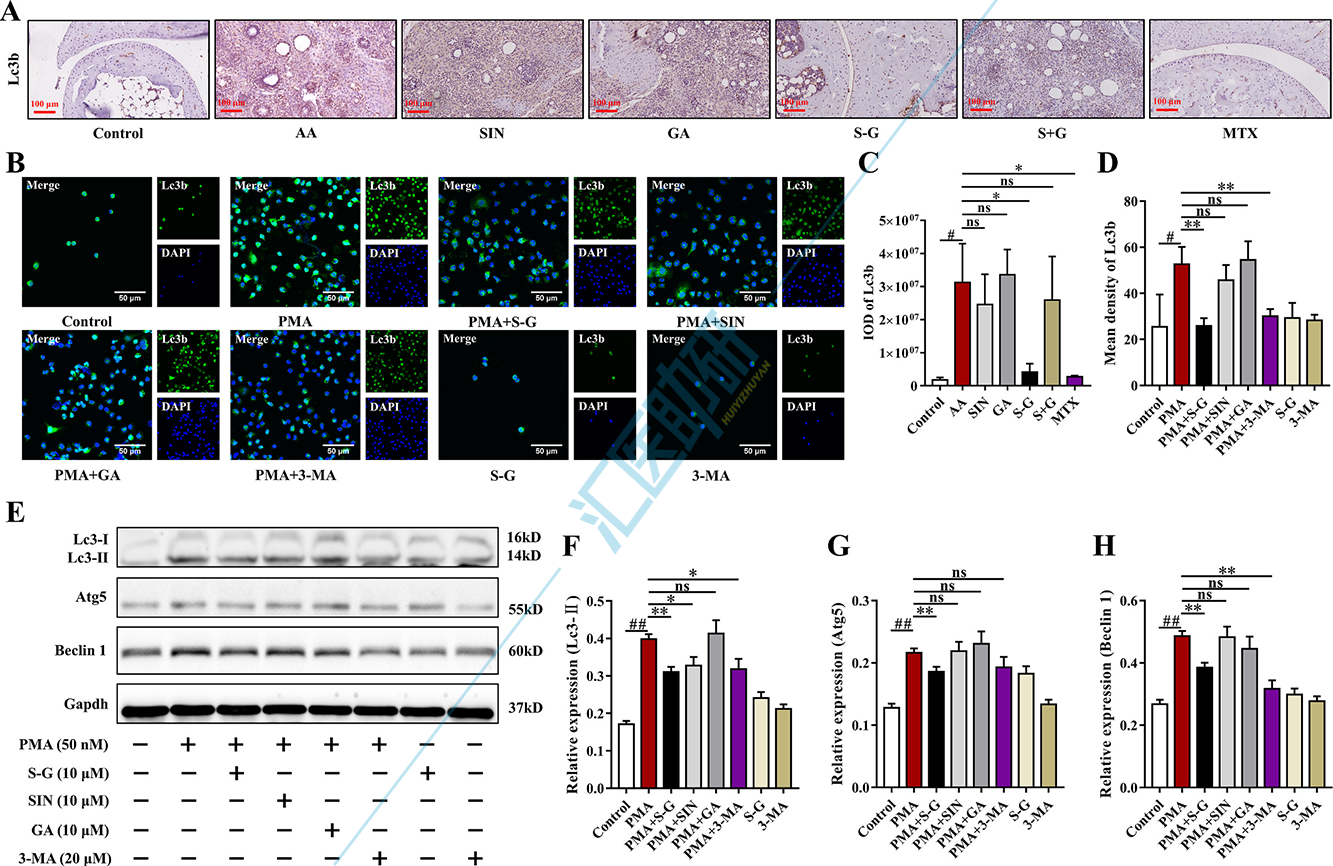 图9.S-G水凝胶在体内外抑制自噬过程