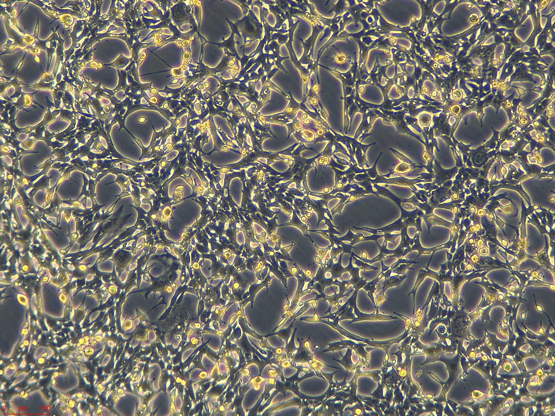 Project1002_PY8119 10X_ch00.jpg