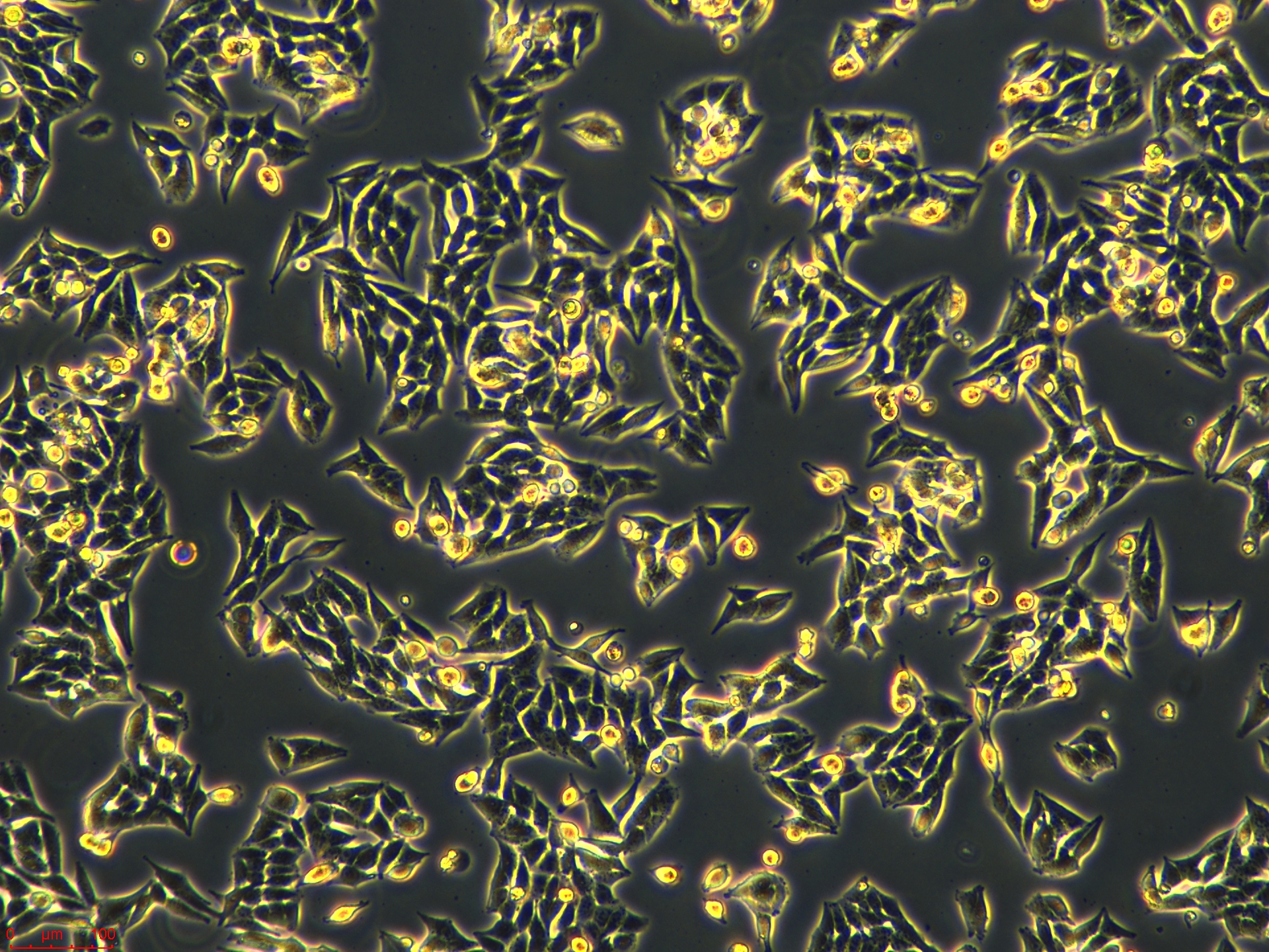 Project1_A-375  10X_ch00.jpg