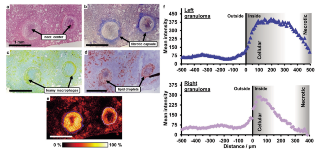 与典同行|质谱成像助力药物研究进入“空间组学”时代