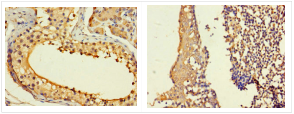 Epigentek-ASF1B多克隆抗体限时促销，错过不再有！