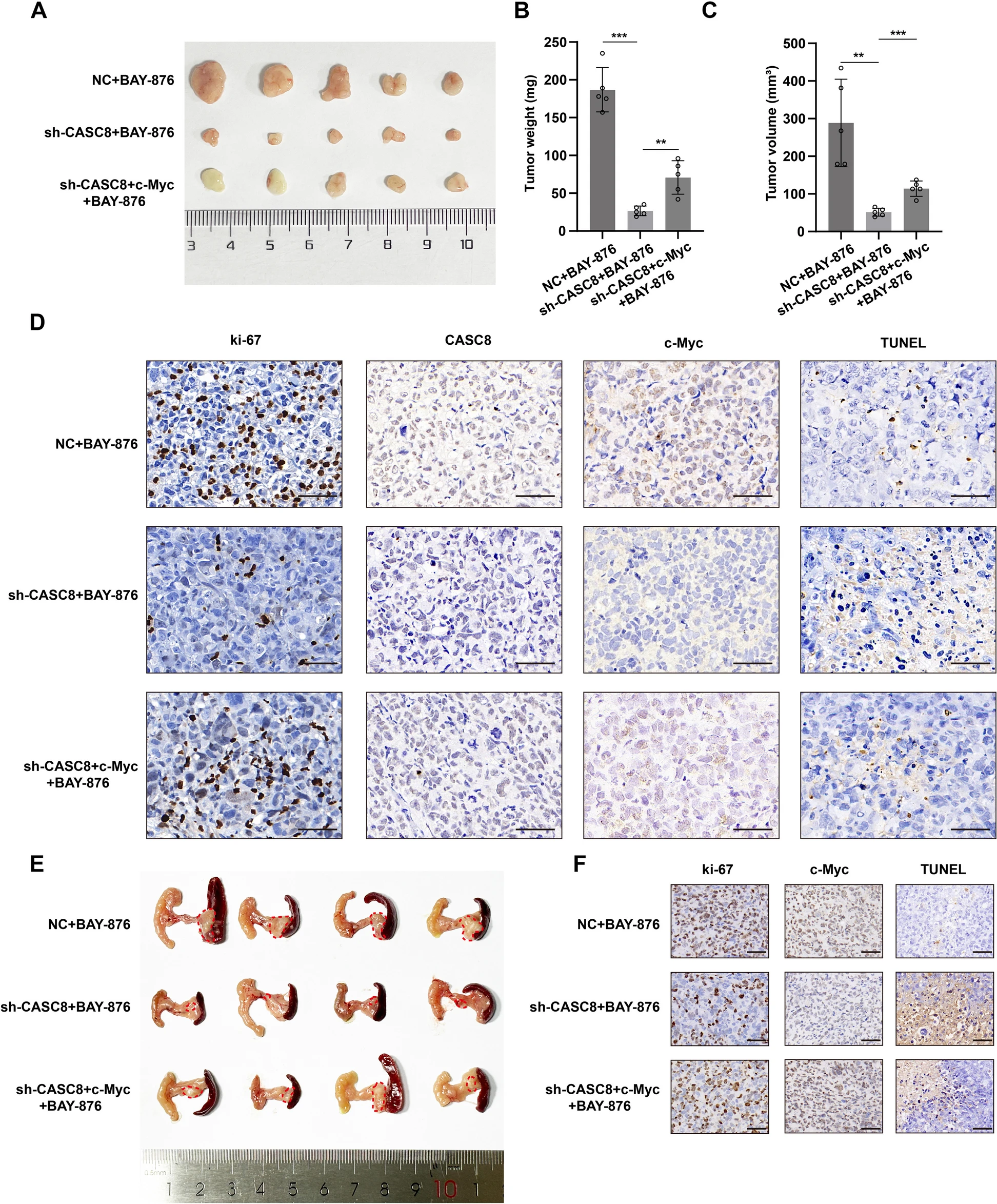 IF：12.8，高分捷径！单细胞×双硫死亡双热点碰撞，预后分析+多实验支撑，顶刊级发文模板！