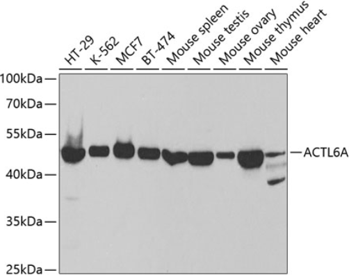 Epigentek-ACTL6A多克隆抗体，促销优惠多！快来抢购！