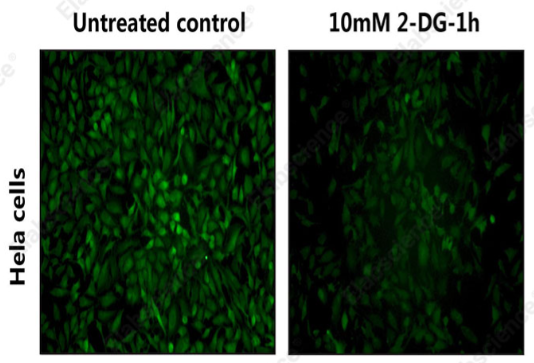 2-NBDG葡萄糖摄取检测试剂盒