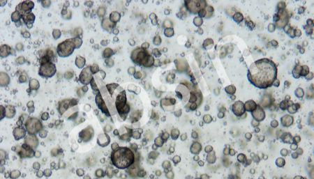 选高活性因子, 养大个类器官