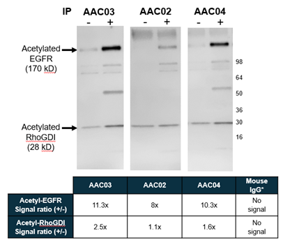 限时钜惠！Cytoskeleton Signal-Seeker 全线产品85折起！