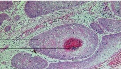 病理染色的成败关键！样本前处理核心技巧与避坑指南