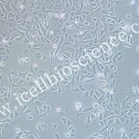 MKN-1 | MKN-1细胞 | MKN1细胞 | MKN1 | 人胃癌细胞 | STR鉴定