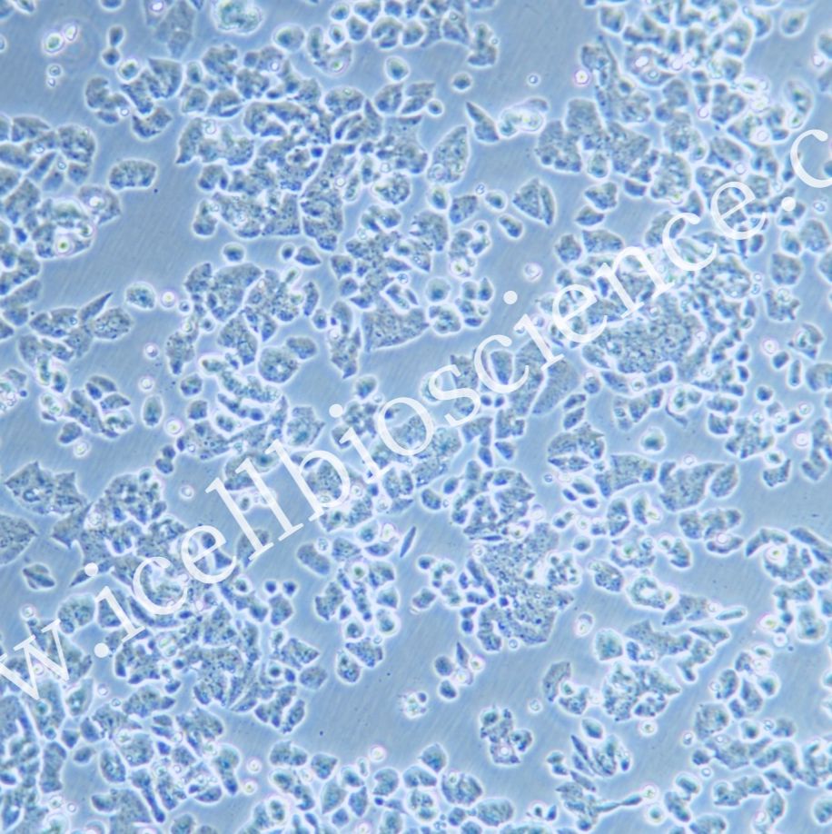 NCI-H1048 | NCI-H1048细胞 | 人小细胞肺癌细胞 | STR鉴定 | 镜像绮点（Cellverse）