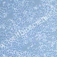 NCI-H1048 | NCI-H1048细胞 | 人小细胞肺癌细胞 | STR鉴定 | 镜像绮点