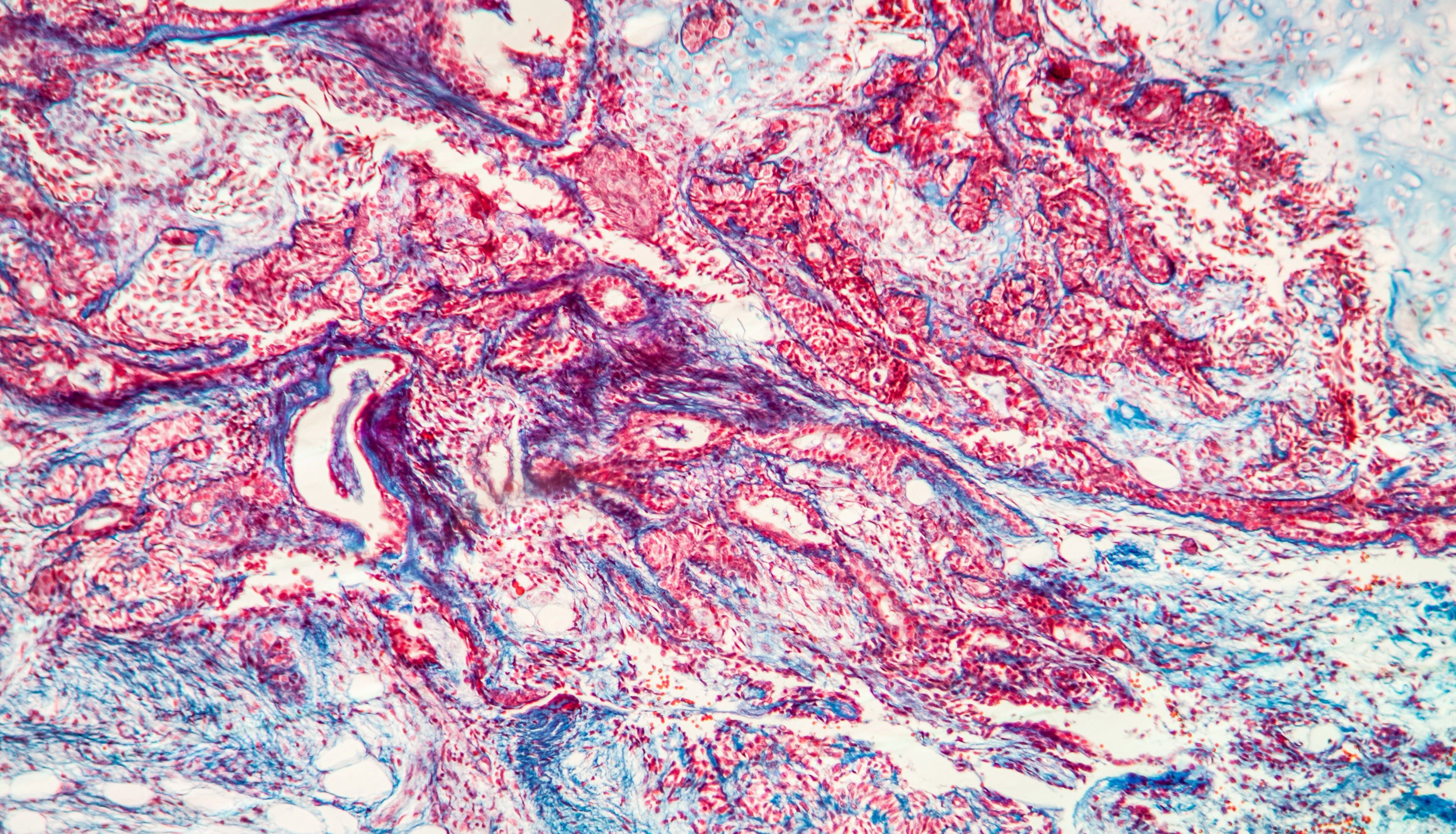 青春因子——GDF-11