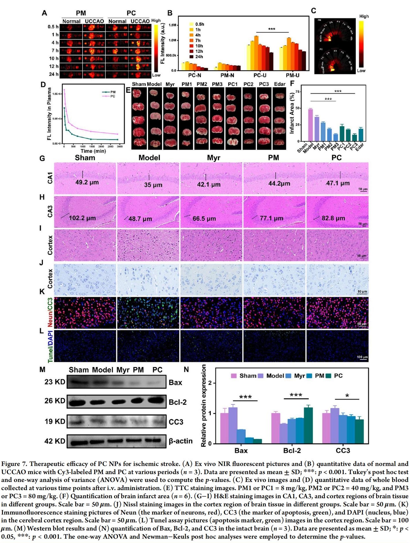 科研加油站 | 杨梅素低聚物治疗缺血性中风