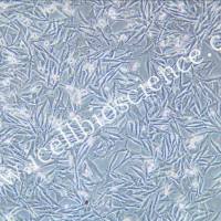 OCM1A细 | OCM1-A细胞 | OCM1A | OCM1-A | 人眼脉络黑色