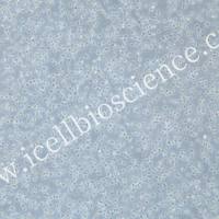 OCI-LY1 | OCI-LY1细胞 | OCILY1细胞 | OCILY1 | 人B细胞