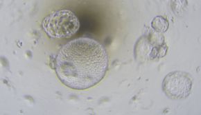 IPS诱导肝类器官培养攻略