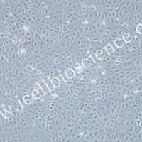 WSU-HN6 | WSU-HN6细胞 | WSUHN6细胞 | WSUHN6 | 人舌