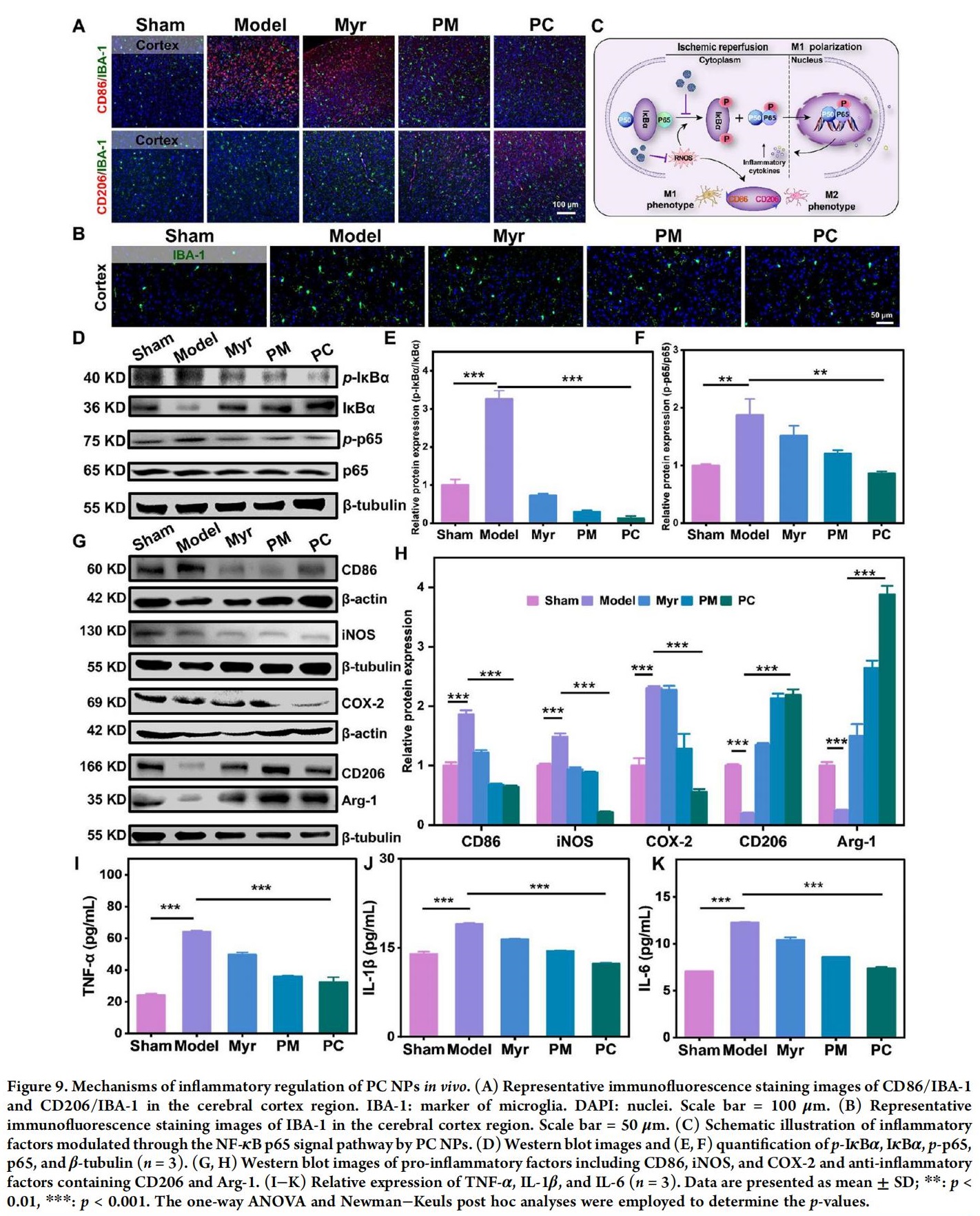 科研加油站 | 杨梅素低聚物治疗缺血性中风