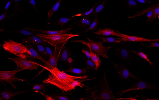 大鼠气管平滑肌细胞-Rat Tracheal Smooth 