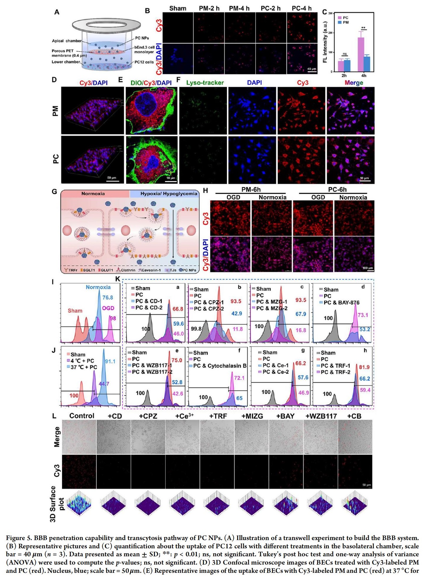 科研加油站 | 杨梅素低聚物治疗缺血性中风