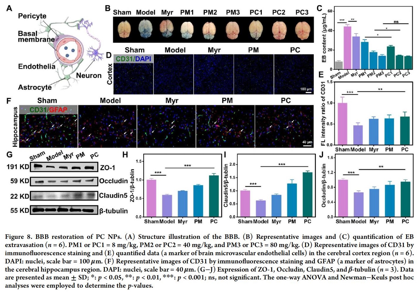 科研加油站 | 杨梅素低聚物治疗缺血性中风