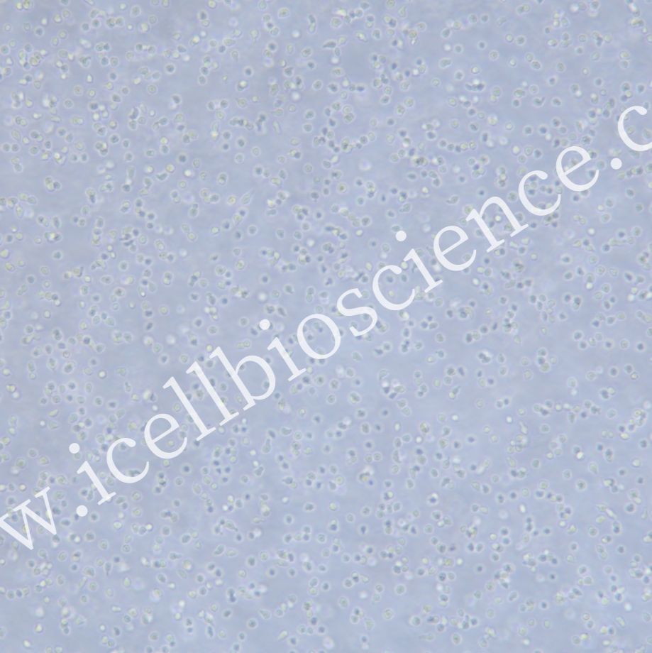 OCI-LY19细胞 | OCI-LY19细胞 | OCILY19细胞 | OCILY19 | 人B细胞淋巴瘤细胞 | 镜像绮点(Cellverse)