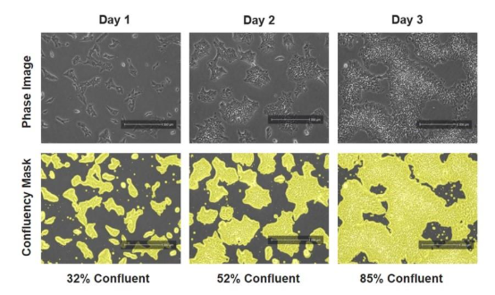 细胞成像数据显示，使用 EVOS M3000 对诱导的多能干细胞进行了随时间成像，显示出细胞的融合性