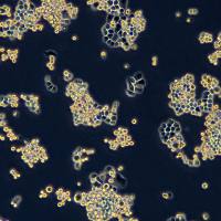 浙江（杭州）美森 人乳腺癌细胞 MDA-MB-453