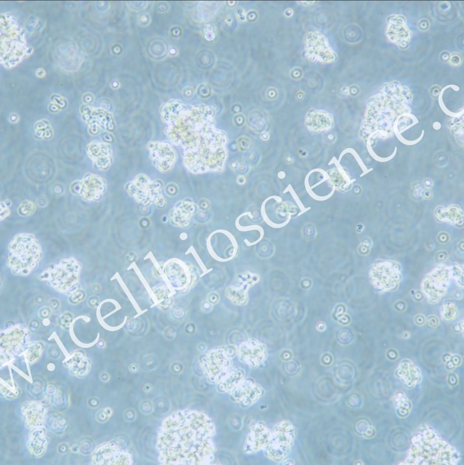 OCI-LY7  |  OCI-LY7细胞  |  OCILY7细胞  |  OCILY7细胞  |  人弥漫大B细胞淋巴瘤细胞  |  镜像绮点（Cellverse）