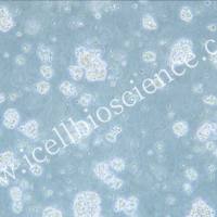 OCI-LY7  |  OCI-LY7细胞  |  OCILY7细胞  |  OCILY7细胞