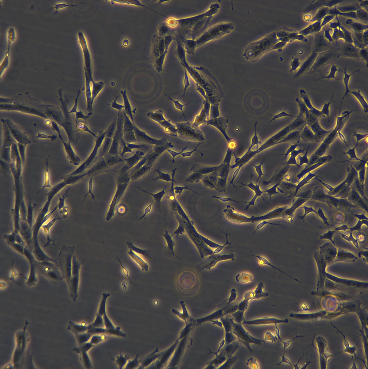 浙江（杭州）美森 人神经母细胞瘤细胞 SK-N-SH