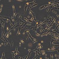 浙江（杭州）美森 人神经母细胞瘤细胞 SK-N-SH