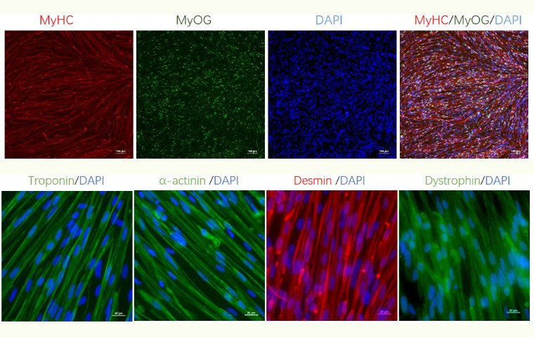 从“全能”到“肌能” | 昂朴hiPSC来源的骨骼肌细胞分化技术及应用全解析