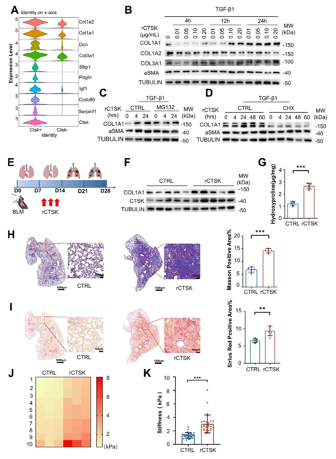 组织蛋白酶K通过促进成纤维细胞谷氨酰胺代谢和胶原蛋白合成加重肺纤维化