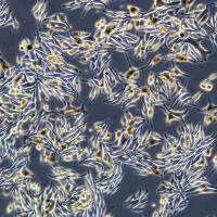 浙江（杭州）美森 人黑色素瘤细胞 MNT-1