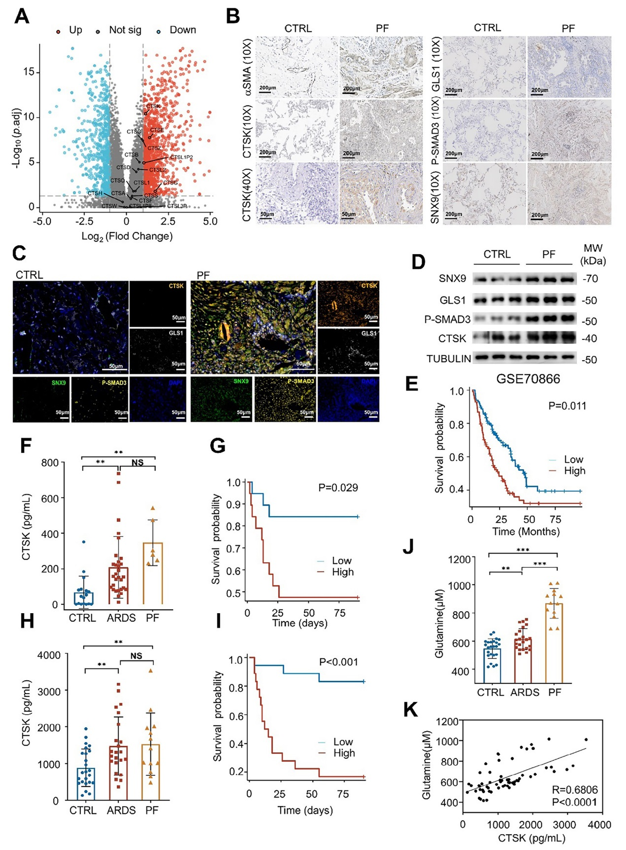 组织蛋白酶K通过促进成纤维细胞谷氨酰胺代谢和胶原蛋白合成加重肺纤维化