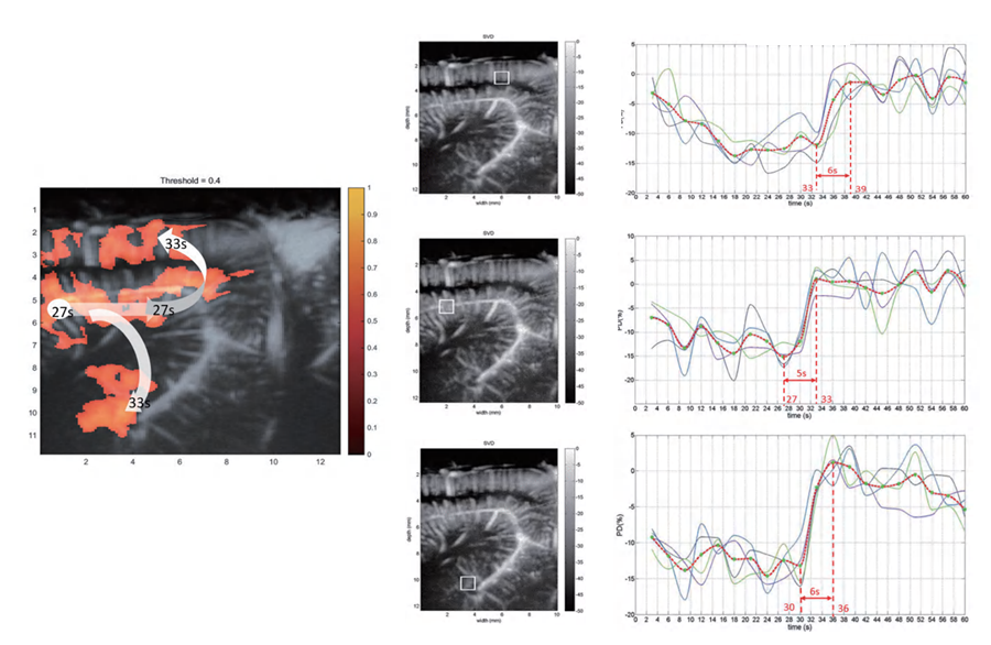 小动物脑功能超声成像系统