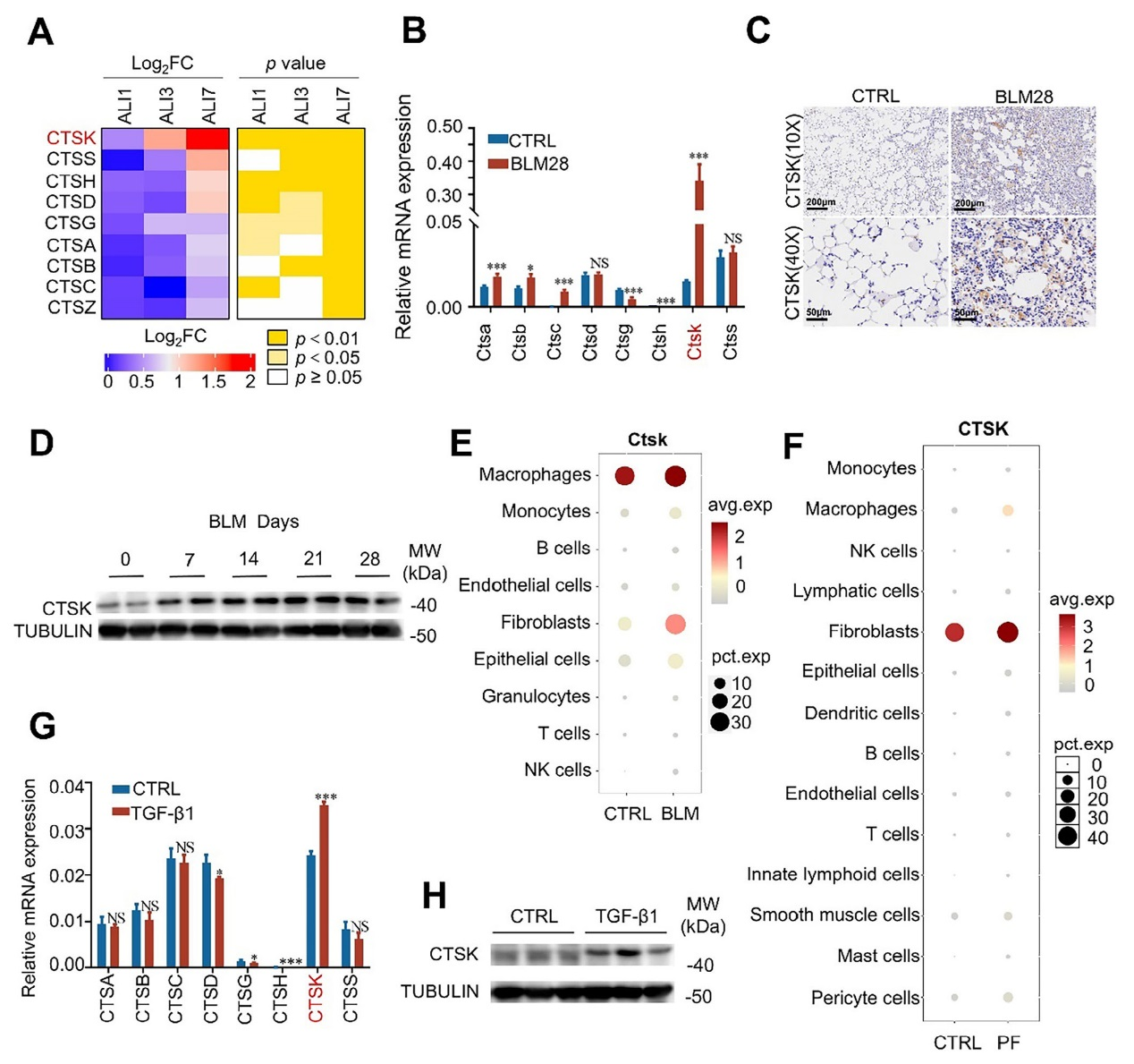 组织蛋白酶K通过促进成纤维细胞谷氨酰胺代谢和胶原蛋白合成加重肺纤维化