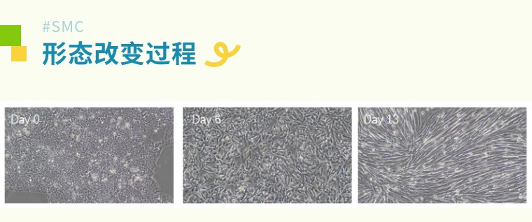 从“全能”到“肌能” | 昂朴hiPSC来源的骨骼肌细胞分化技术及应用全解析