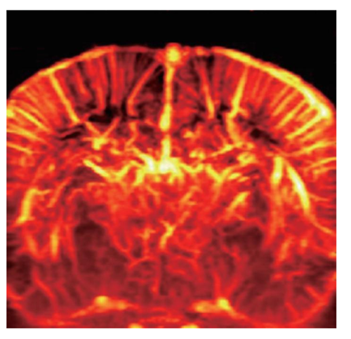 小动物脑功能超声成像系统