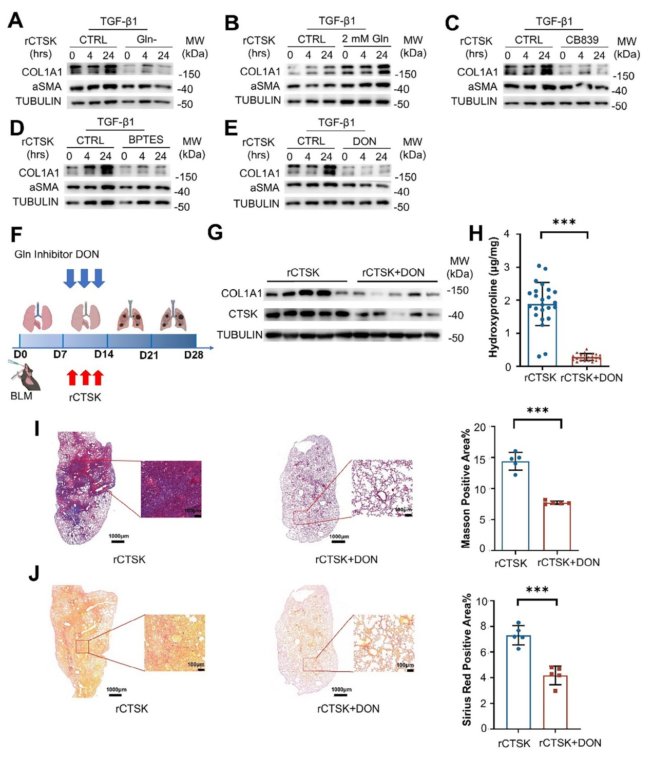 组织蛋白酶K通过促进成纤维细胞谷氨酰胺代谢和胶原蛋白合成加重肺纤维化
