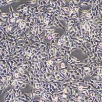 小鼠黑色素瘤细胞;B16(种属鉴定)