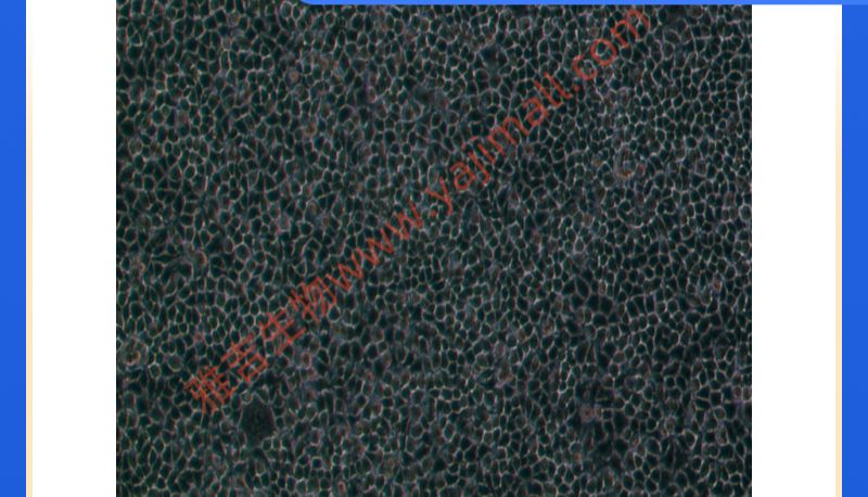 人T淋巴细胞白血病细胞A3