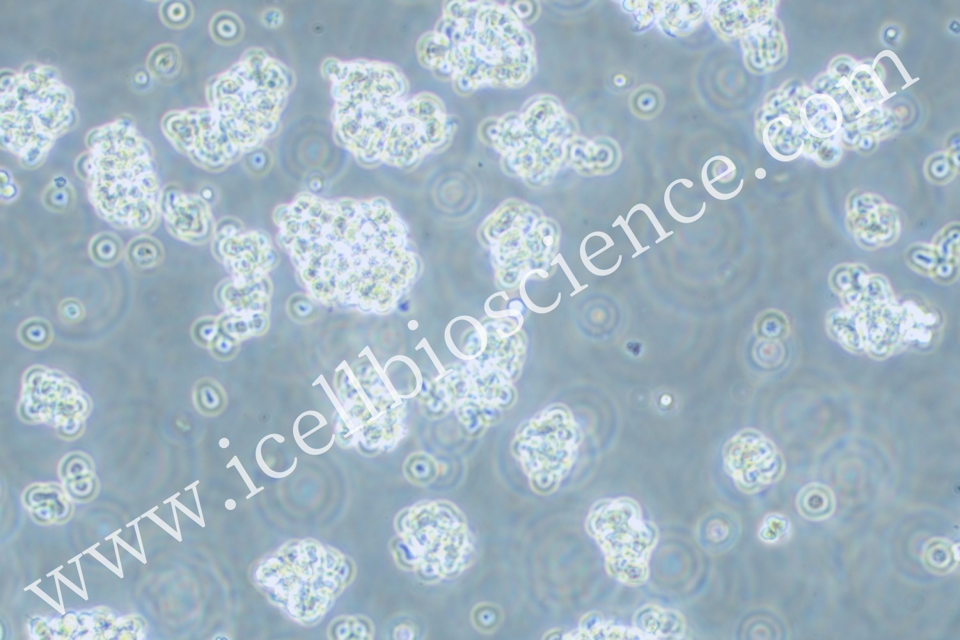 OCI-LY7  |  OCI-LY7细胞  |  OCIL