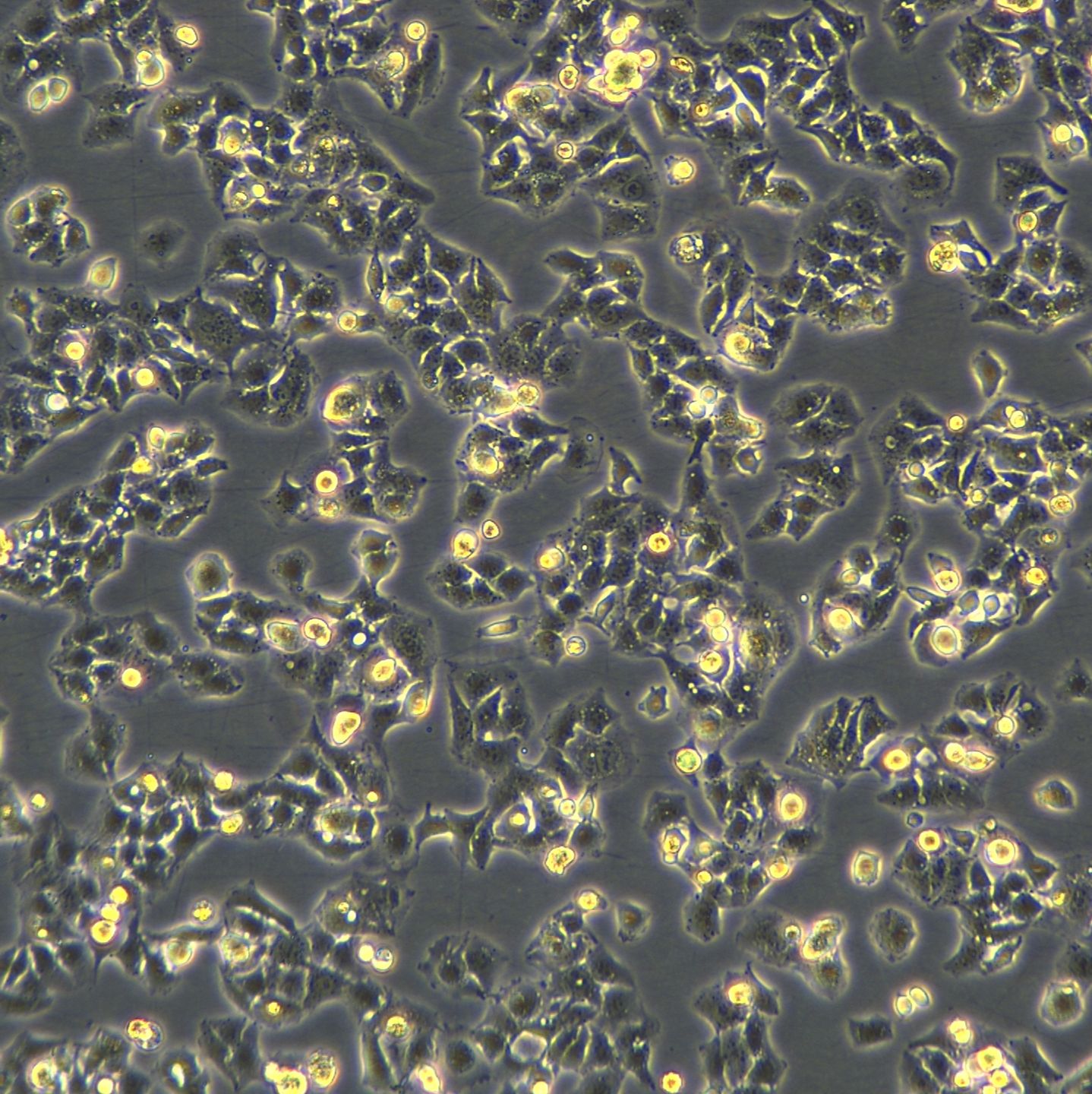 浙江（杭州）美森 人肝癌细胞 JHH-7