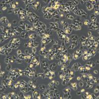 浙江（杭州）美森 人肝癌细胞 JHH-7